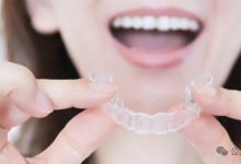 AI视觉系统助力牙齿矫治器制造链条实现自动化检测